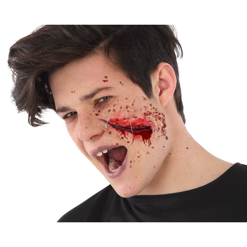 Cicatriz Con Grapas 24x10 cm