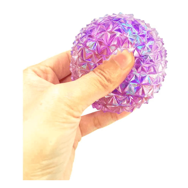 Squishy Bola Diamante Con Brillo Surtida
